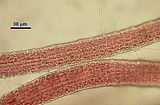 3 - Cellule corticali in visione superficiale
